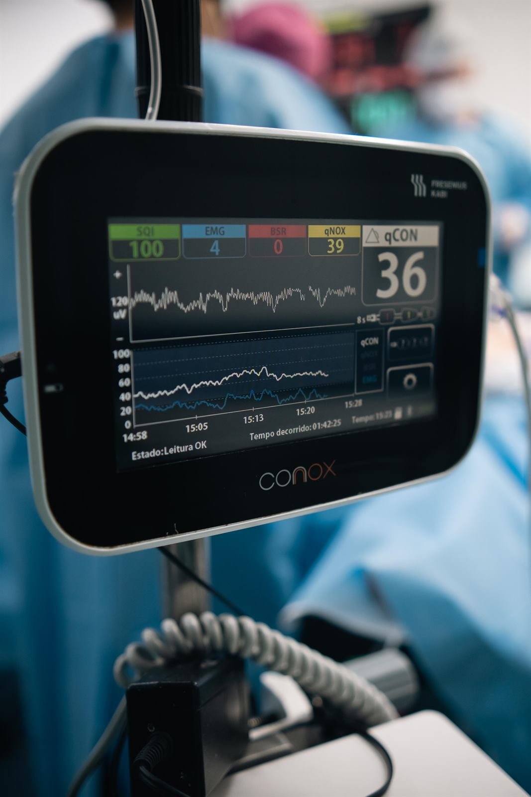 Monitor de profundidade anestésica durante procedimento